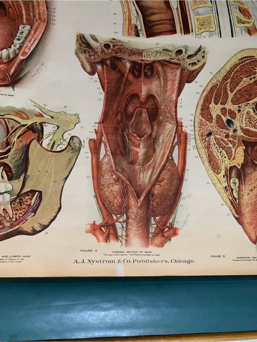 Antique American Frohse Anatomical Chart Head and Neck Signed Max Brotel 1919 - Picture 15 of 16